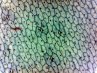 Leaf epidermis (prepared microscope slide)
