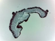Lichen, cross-section (prepared microscope slide)