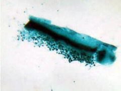Aspergillus Fungus Microscope Slide