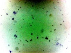 Bacteria (From Human Mouth) Microscope Slide