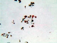 Fern Spores (Germinating) Microscope Slide