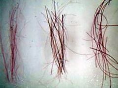 Hair (Three Types) Microscope Slide