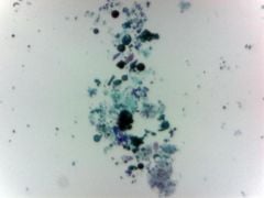 Algae, green (prepared microscope slide)