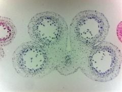 Lily meiosis, first division (prepared microscope slide)