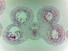 Lily meiosis, second division (prepared microscope slide)