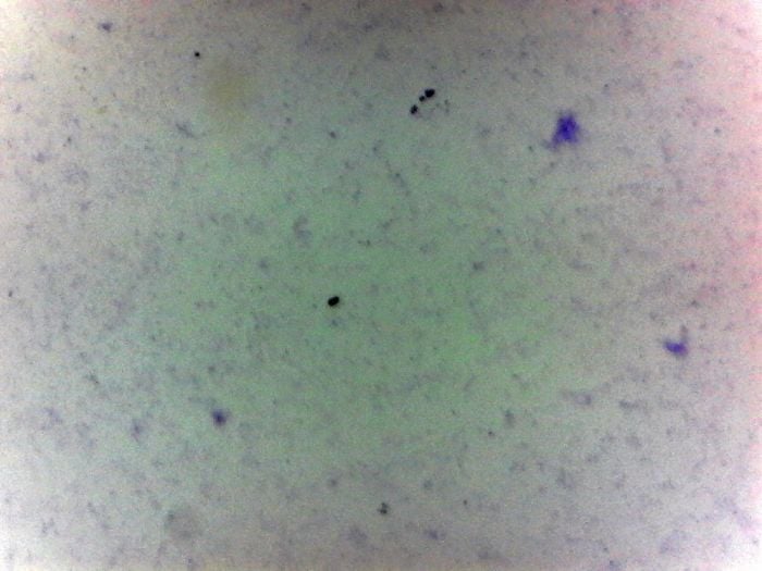Bacteria, three types (prepared microscope slide)