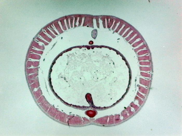 Earthworm, posterior cross-section (prepared microscope slide)