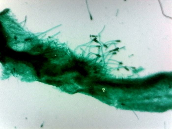 Mold, three types, Aspergillis, Penicillium, Rhizopus (prepared microscope slide)