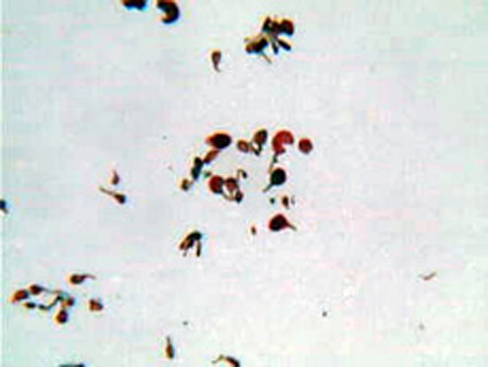 Fern spores, germinating (prepared microscope slide)