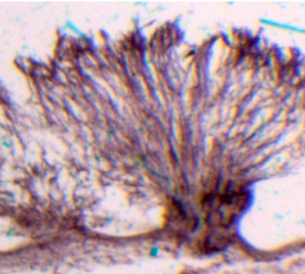 Mold, bread, mycelium (prepared microscope slide)